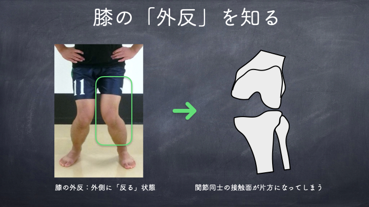 膝　外反を知る